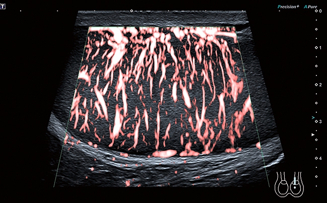 CANON/Toshiba Aplio i700