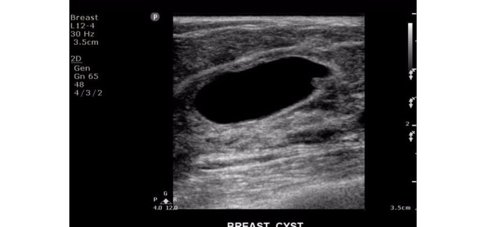 Philips ClearVue 650