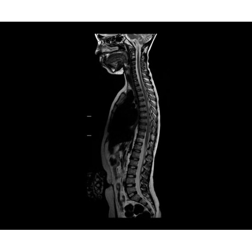 МРТ аппарат GE SIGNA Architect 3.0T